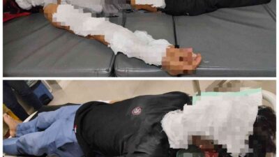 Mesin Pengering Ompreng Meledak di Ngoro, Dua Pekerja WK Catering Alami Luka Bakar